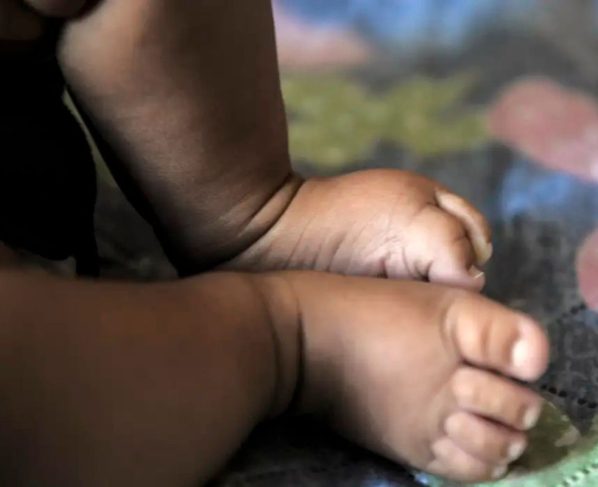 A imagem mostra os pés de um bebê