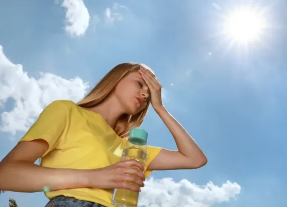 Calor de 34°C