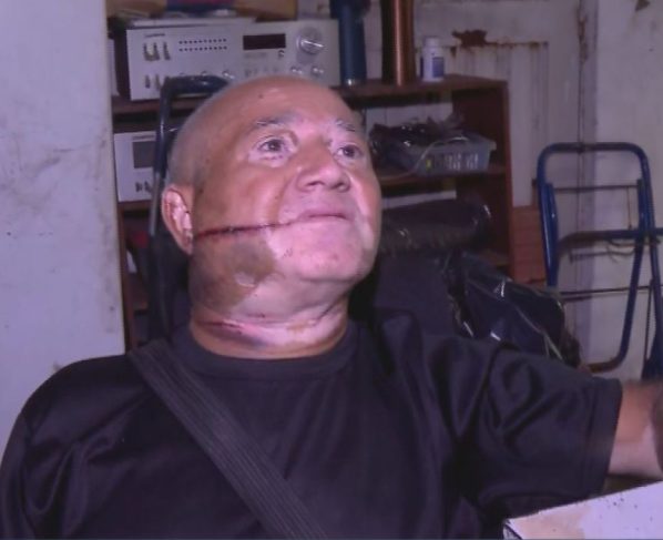Comerciante, Gezo Barbosa da Silva, de 71 anos, foi agredido com golpe de facão durante tentativa de furto
